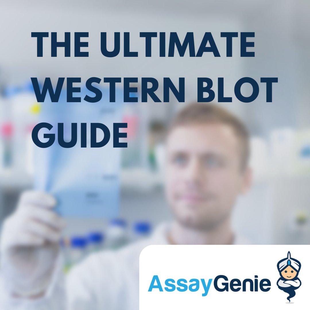 AssayGenie's tweet image. Need help with your western blots? 

We have the ultimate guide to western blots available at:
assaygenie.com/western-blot-p…
