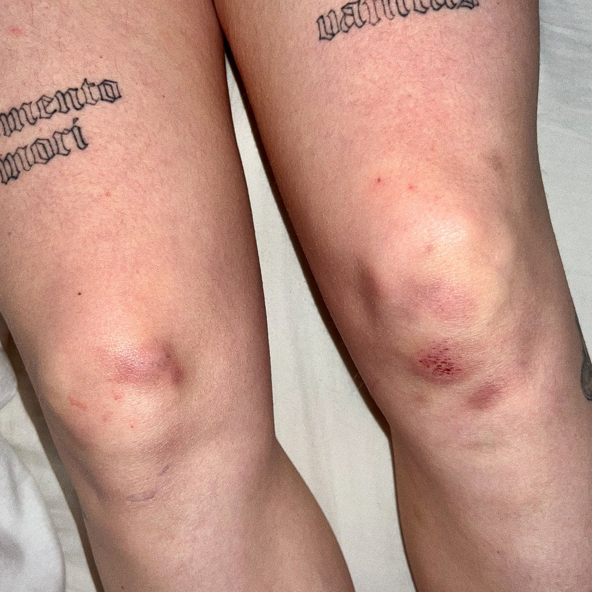 not_milkplus's tweet photo. ouch

https://t.co/P6epZn9mLv https://t.co/OjqmUBEvHH