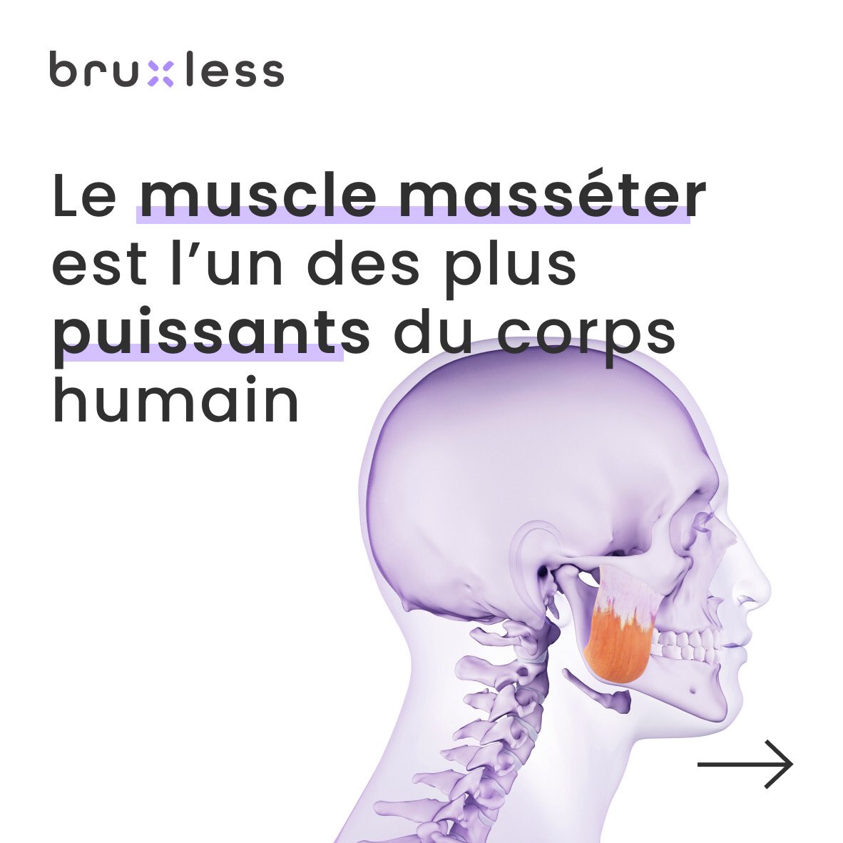 bruxless's tweet photo. Le muscle masséter est un des plus puissants du corps humain. Il peut exercer une force de 58 kg par cm2. Le crocodile exerce une pression de 1113 kg. Certains bruxomanes ont une hypertrophie des muscles masséters
#masseters  #bruxisme #bruxismo #bruxism #bruxless #medtech https://t.co/8YXWUTXY98