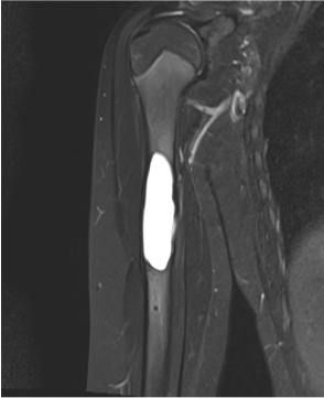 Lurie Children’s Radiology tweet media