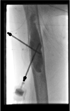 Lurie Children’s Radiology tweet media