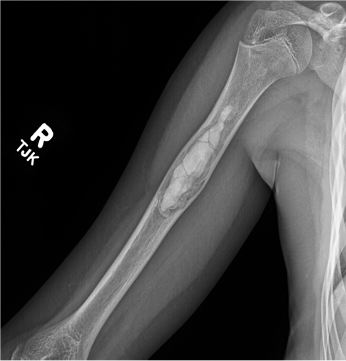 Lurie Children’s Radiology tweet media