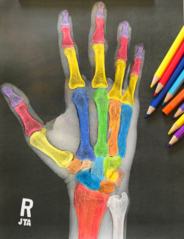 Bone Stories: synesthesia, neurodiversity, and anatomy in colour, by CC Hart, neurodiversity advocate, artist, author, and manual therapist.
Monday, January 23, 2023, 7-8pm ET
Registration tinyurl.com/3t43bp7v 
Zoom link will be sent to registrants one hour before the event
