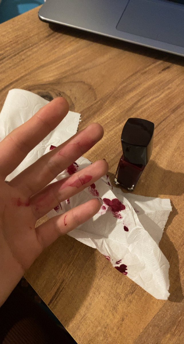 bordo oje surmek hic riskli degil