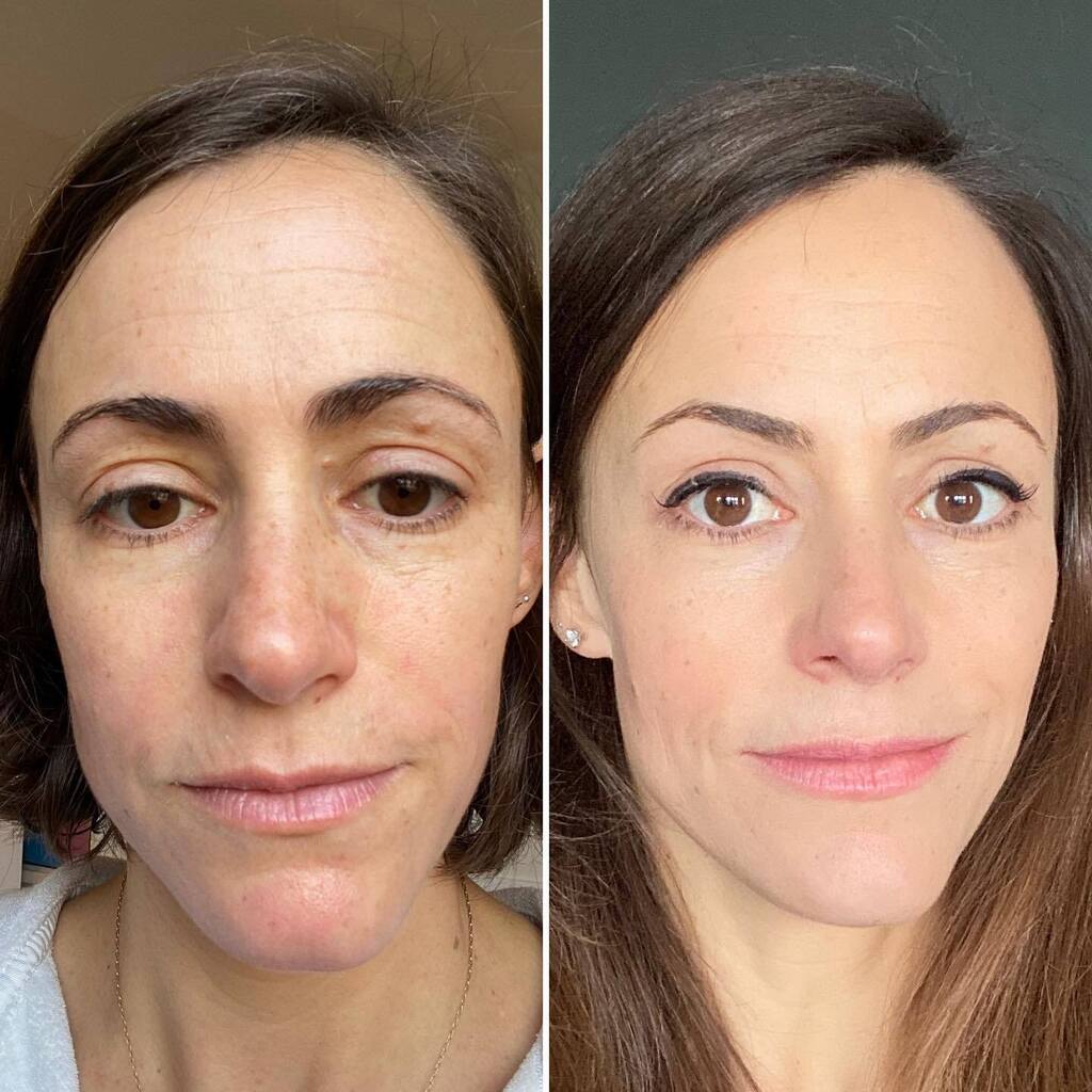 MoCollagenQueen's tweet photo. Consistency is key to success!

2 years ago I started a new routine. 

🧖‍♀️Introducing an anti ageing skincare range (my gorgeous CellProof) and… 

🥄 One spoon a day of something called liquid collagen. This quickly become known as my liquid gold ✨

… https://t.co/OJxB5GNl6q https://t.co/sT0rp2DPSN