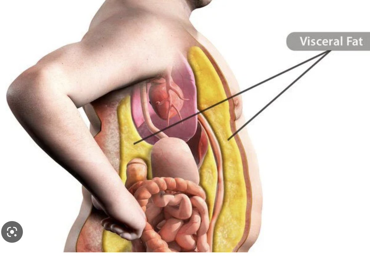 Rob_FitLegacy's tweet image. Got excess belly fat you want to lose?

Make sure you read these 25 fat loss hacks!

#17 will surprise you but it works!