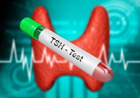 medlineplus's tweet image. A #TSHtest is a blood test that measures the Thyroid Stimulating Hormone. TSH levels that are too high or too low can indicate that your thyroid isn't working correctly. The test can help diagnose a variety of thyroid conditions. ow.ly/fkab50Muyjq #ThyroidAwarenessMonth