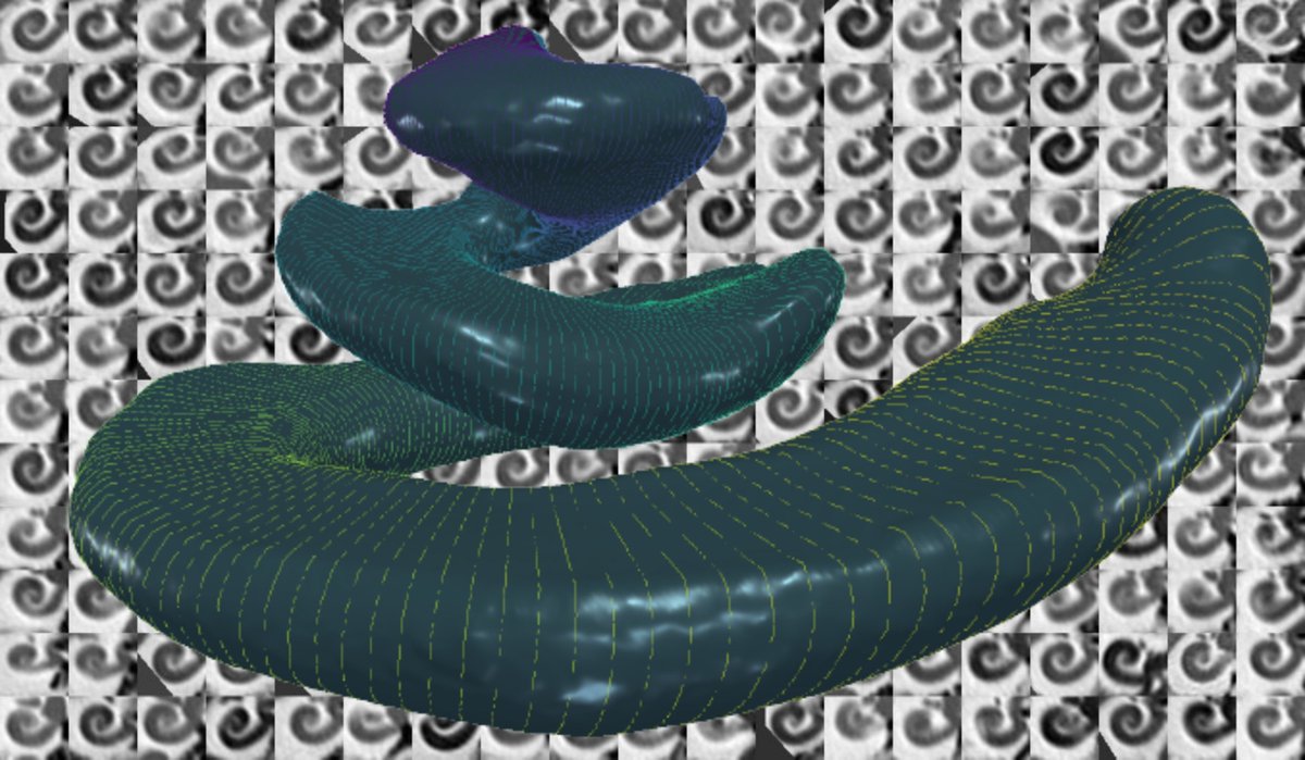 jmargeta's tweet photo. Nautilus strikes again! We set our automated imaging platform to measure 1099 cochleae and our findings are now in JCM: https://t.co/zBfRq4A7zz

Well done, friends at @OticonMedical, @CHUdeNice, @InriaEpione, and @KardioMe!👏

#ent #otology #NewPaper #MedTwitter #Statistics #DL https://t.co/bwHpcF0RPH