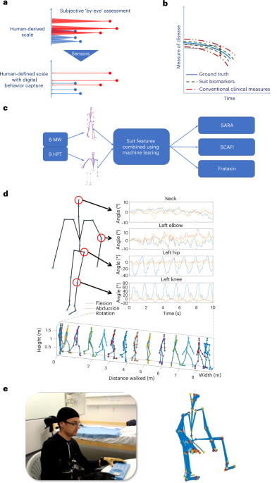 DrMattCrowson's tweet photo. RT A wearable motion capture suit and machine learning predict disease progression in Friedreich’s ataxia https://t.co/uNqaopWQ4D https://t.co/f6P7M5hAsD
