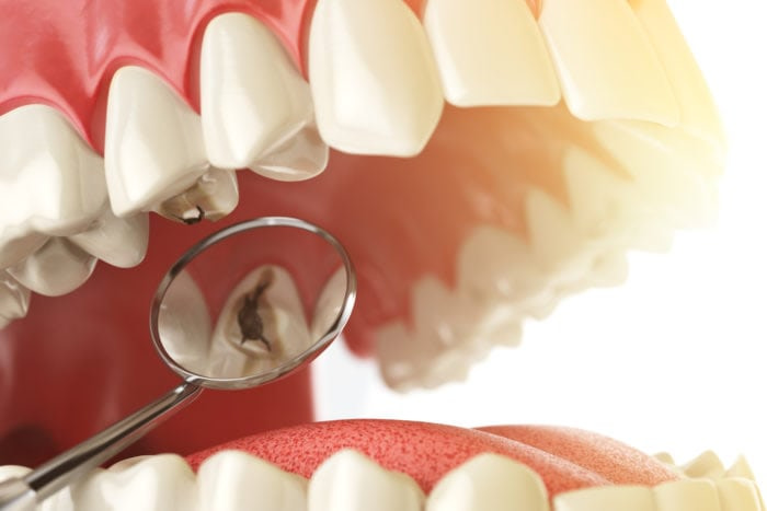 TorbeckDental's tweet photo. Good Brushing Doesn't Always Eliminate All Cavities. Learn Why…
VIEW TIPS... https://t.co/AZ0ckrs1jr
#dental #dentists #cavities #health #smile #teeth #brushing #nky #northernkentucky #burlington #torbeck #torbeckdental https://t.co/bJQCibUWay