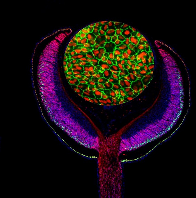 Genetic Risk Factor for #AMD Identified by Combining Experimental and #GWAS Data

Researchers combined a map of gene regulatory sites with disease-associated loci to uncover a new genetic risk factor for #agerelatedmaculardegeneration (AMD). Read more: ow.ly/InUU50MurjS