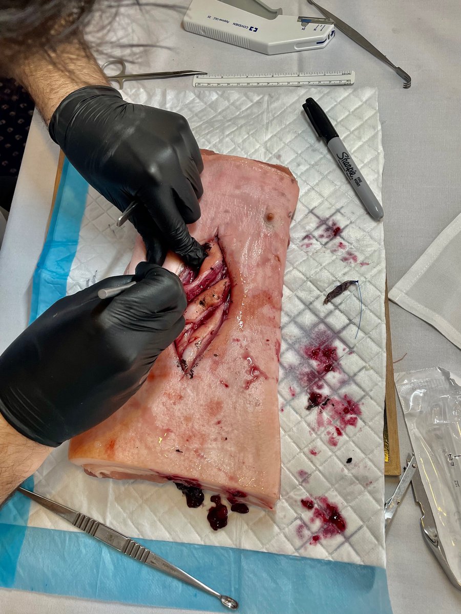 _AnnaRose_'s tweet photo. Amazing first day at the Mid-Yorkshire Plastic &amp; Hand Surgery course 🤚🏼🦴 

@BaronLeSanj https://t.co/jsK4reyUts