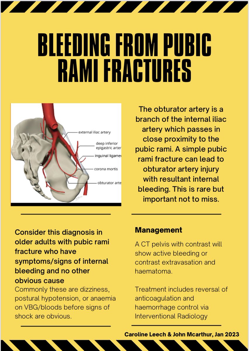 After seeing another case of obturator artery injury, thought it would be useful to share this.  Can present late after injury post-admission ⚠️