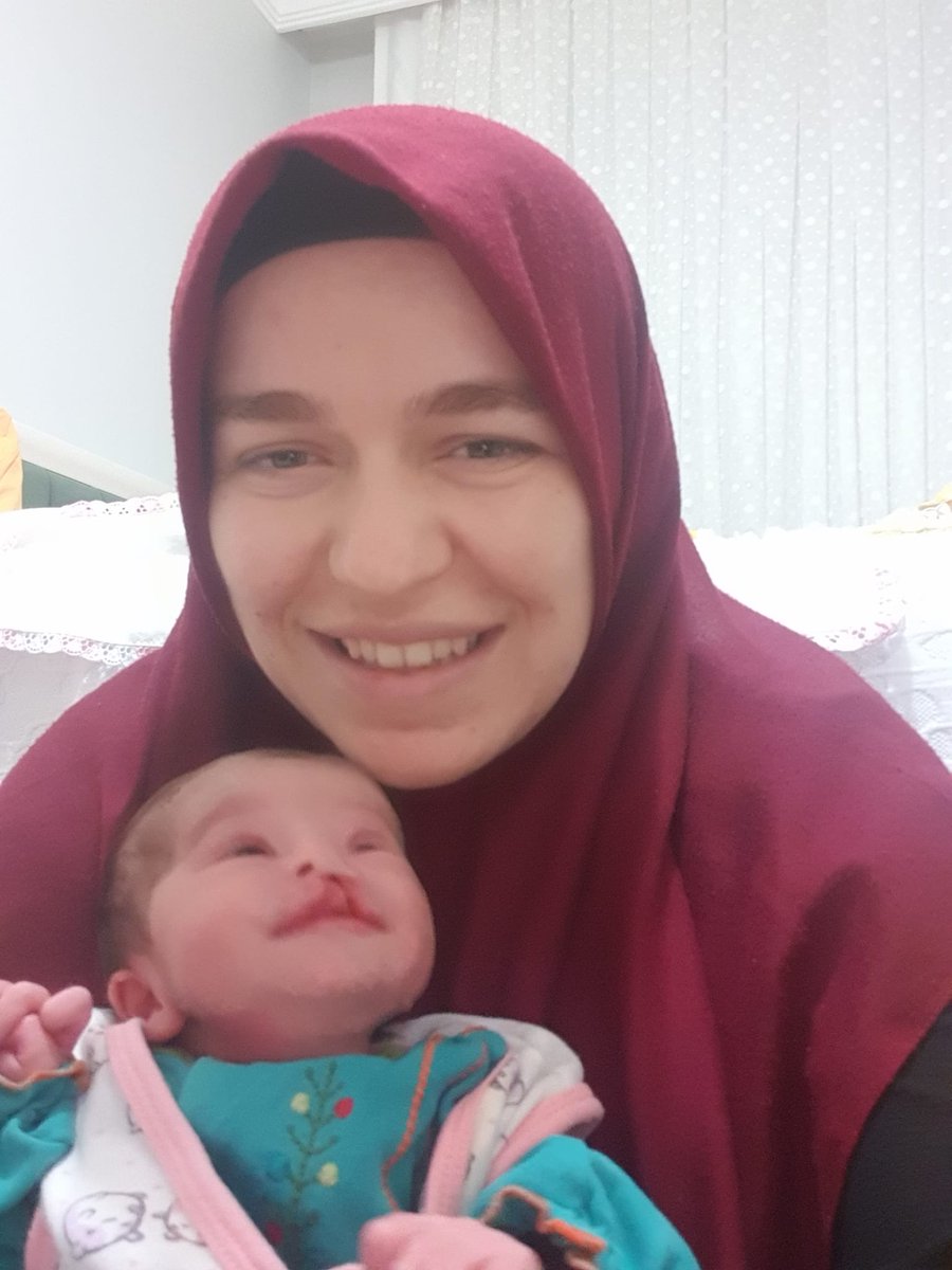 gergerliogluof's tweet photo. Bu 105 günlük hasta bebeğin annesini az evvel tutukladılar!

Vicdansızlık rekoru kırıyorsunuz ! @Akparti

Bu bebek yeni ameliyat oldu ve tedavide hijyen önemli

Anne Emine Coşkun, bebek Seniha bahar 

"Kızım tutuklandı, bebeği 3 aylık dudak yarığı ve anal vajinal yırtığı var" https://t.co/za5d7YXHio
