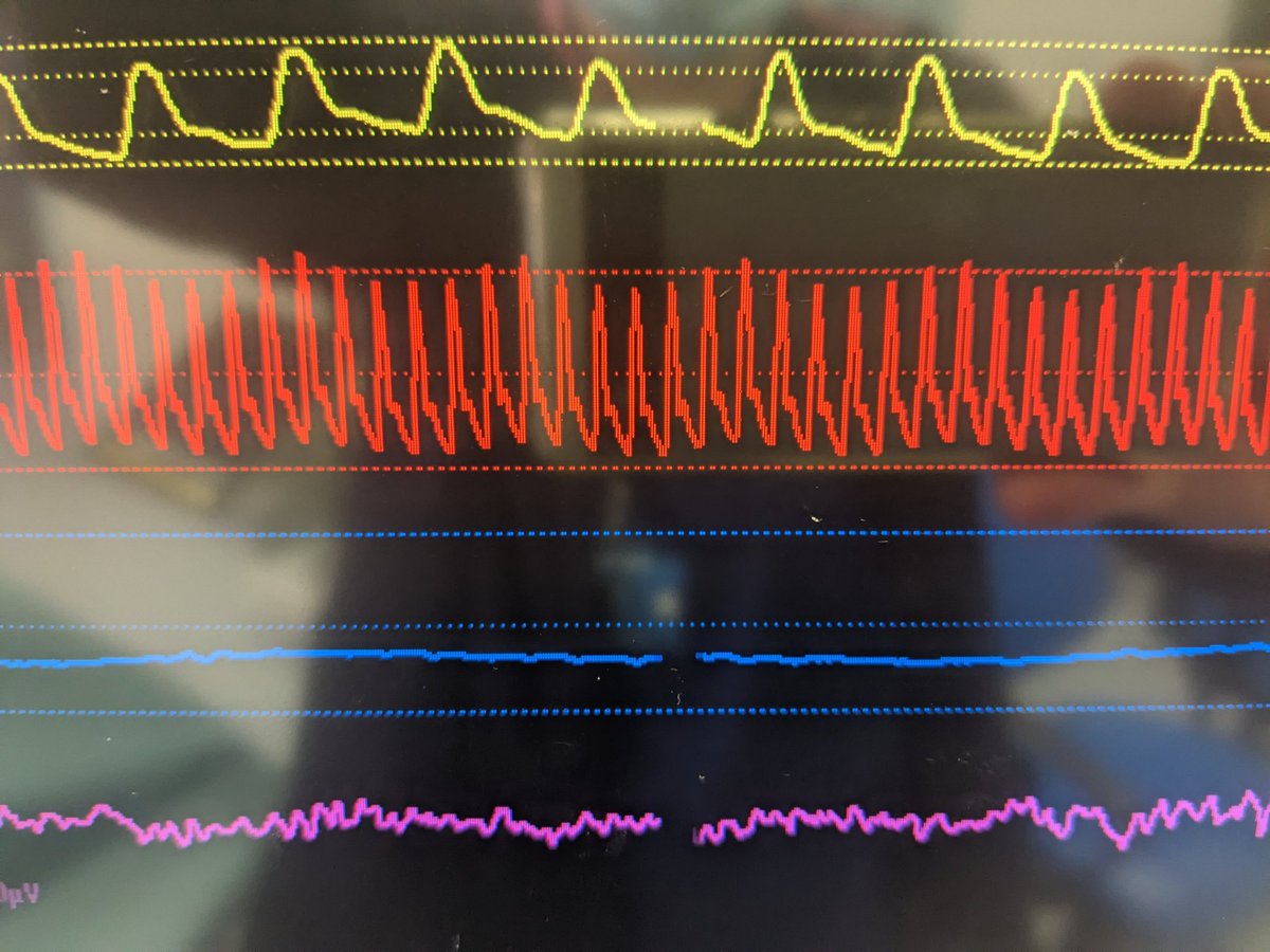 Jakob Mathiszig-Lee tweet media