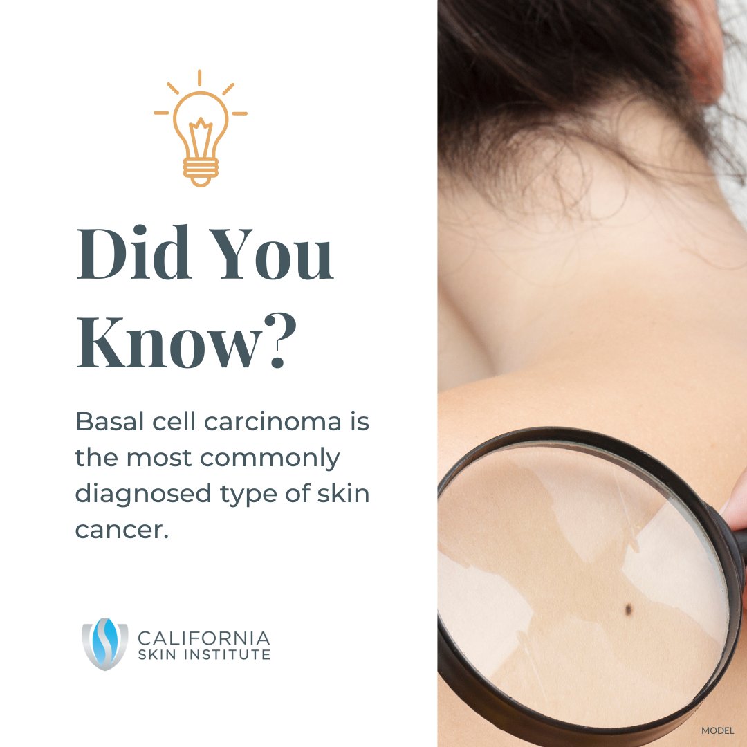 CSIskinexperts's tweet photo. 💡Did you know?

Basal cell carcinoma accounts for over 90% of all skin cancers in the U.S. with an estimated 3.6 million Americans diagnosed every year.

Learn the warning signs of basal cell carcinoma and how to catch it and treat it early: https://t.co/GHzN5QIJqn https://t.co/agqQA0whpS