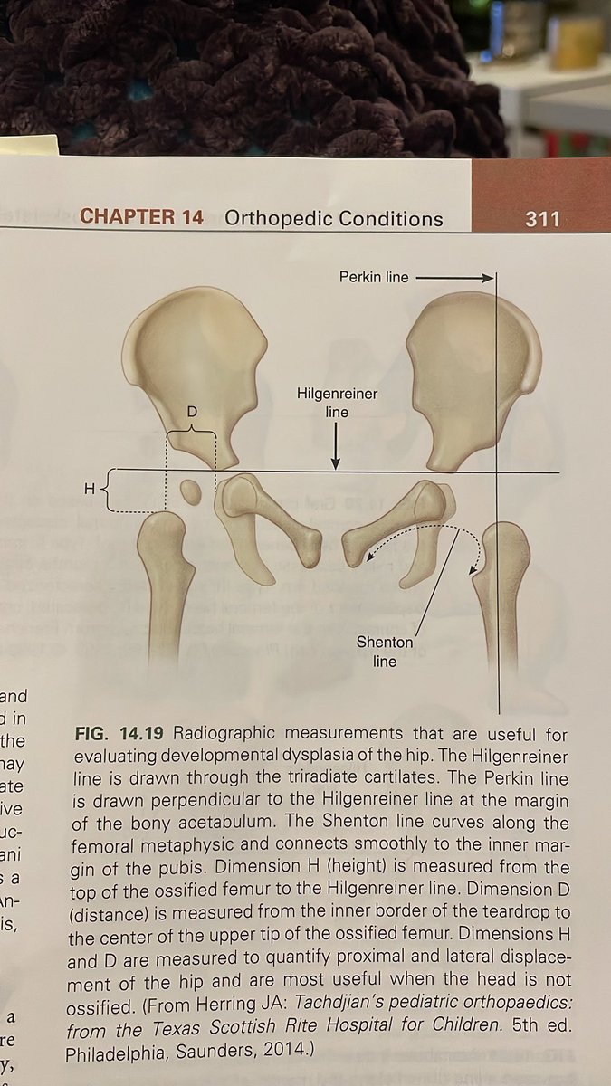 And on this episode of “children are not small adults” I present…baby hips