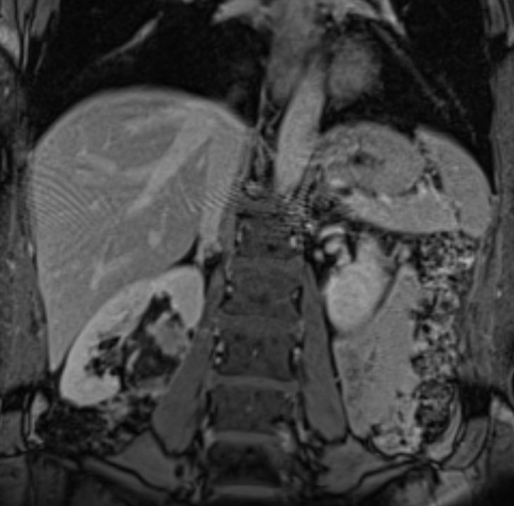 David Léon MD tweet media