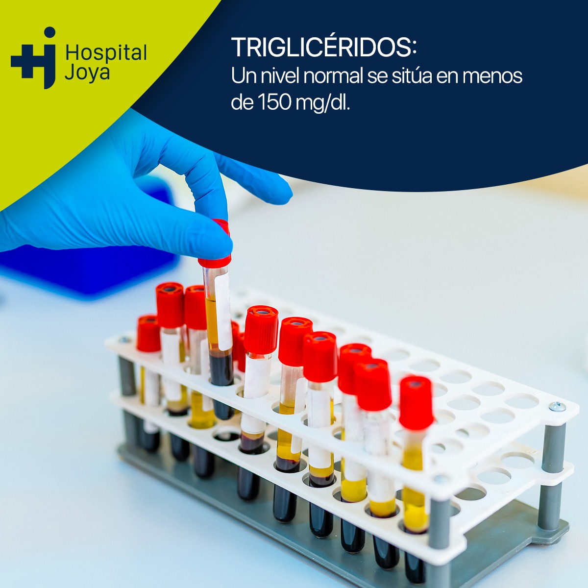 En Hospital Joya creemos es fundamental sensibilizar acerca de la importancia de la prevención, ya que es una de las principales intervenciones en salud que se pueden realizar para mejorar la calidad de vida. 
Aquí de dejamos los 4 indicadores más importantes a tener en cuenta.