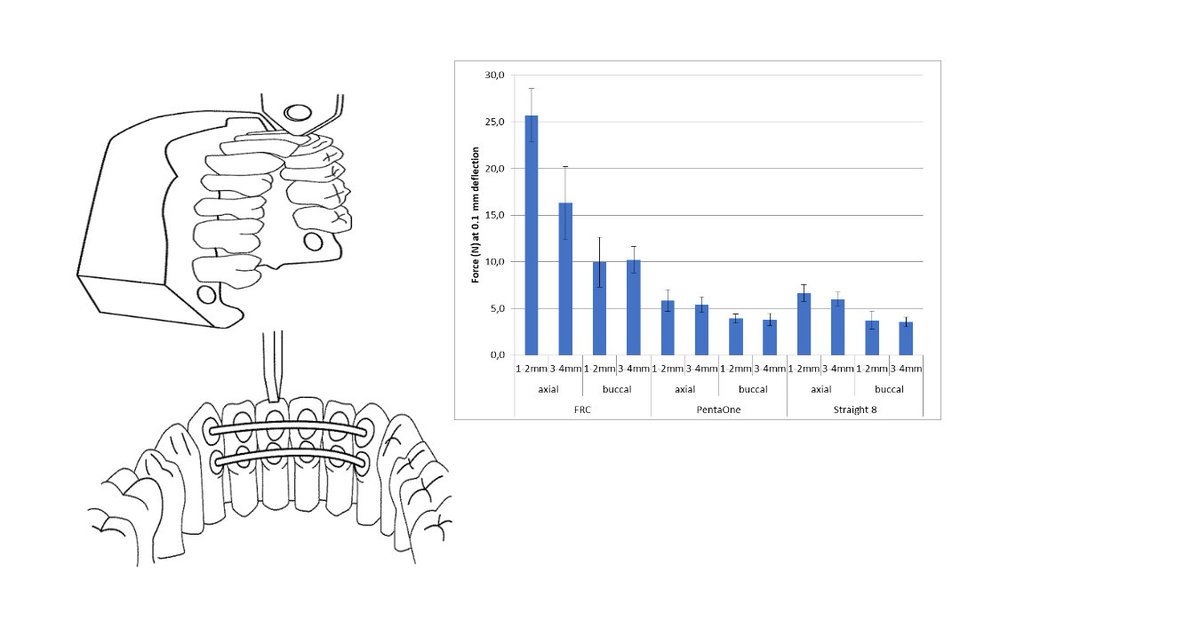 Materials_mdpi's tweet image. #Publishedpaper
Welcome to read:

The Effect of Material Type and Location of an #Orthodontic #Retainer in Resisting Axial or Buccal Forces 

👉Full Paper: mdpi.com/1996-1944/14/9…
📝Authored by Dr.  Jaana Ohtonen et al.

#orthodontic FRC retainer; 
#HS glass; 
#composite