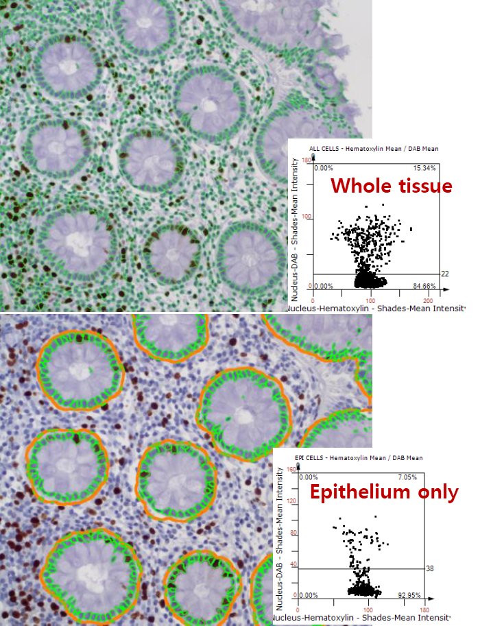 1stPhilekorea's tweet photo. PhileKorea Tech's 1st webinar of 2023
We introduce an AI-based analysis that analyzes the tissue with the TissueGnostics Solution and the tissue or cultured cell as FACS result without dissolving the cells.
#TissueGnostics #SpatialBiology #gating #ImmuneMarker #Bric #웨비나 https://t.co/ucUCtB7Q39