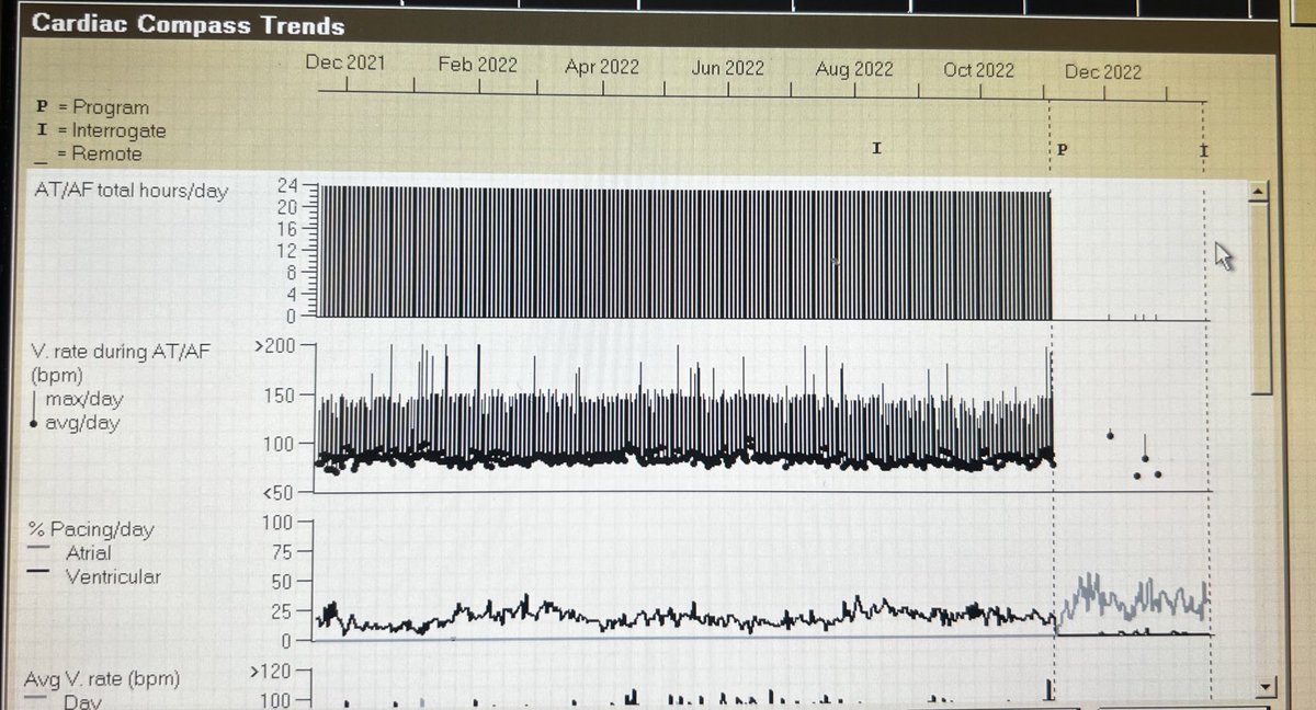 MejiaEliany's tweet photo. This patient made my day… Post ablation device check. #ablateAfib #zerofluoro #afib #EPeeps https://t.co/4qsOqHsVKI