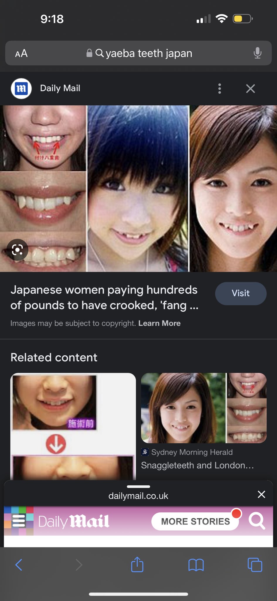 ReddDarling on Twitter "aliyahInterlude I wanted to get braces so bad