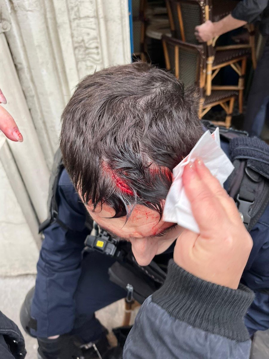 mvalet_officiel's tweet photo. Hier après avoir protégé la #Manif19Janvier contre la #ReformesDesRetraites, ce #policier d’une compagnie d’intervention de #Paris est rentré chez lui avec des stigmates.
Défiguré par 7 points de suture après avoir été agressé par des Blackblocs.
Merci à ces #policiers courageux. https://t.co/u4q6xXHIPL