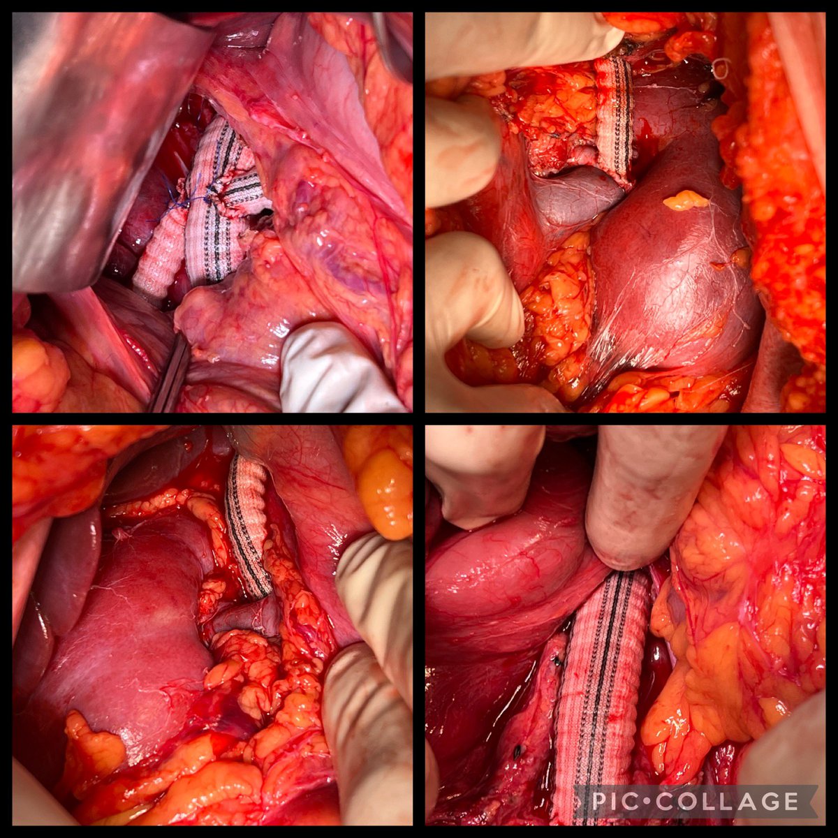 Dr Shivanesan Pitchai tweet media