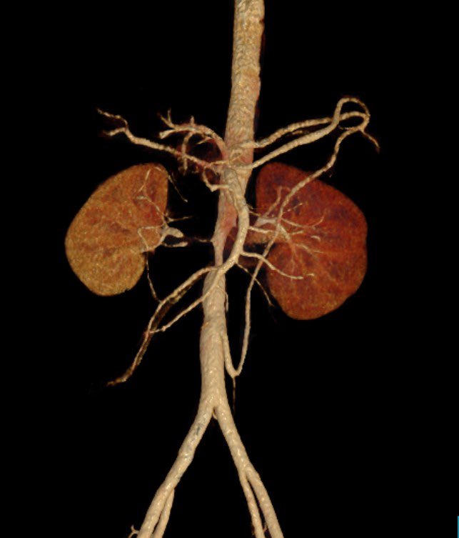 Dr Shivanesan Pitchai tweet media