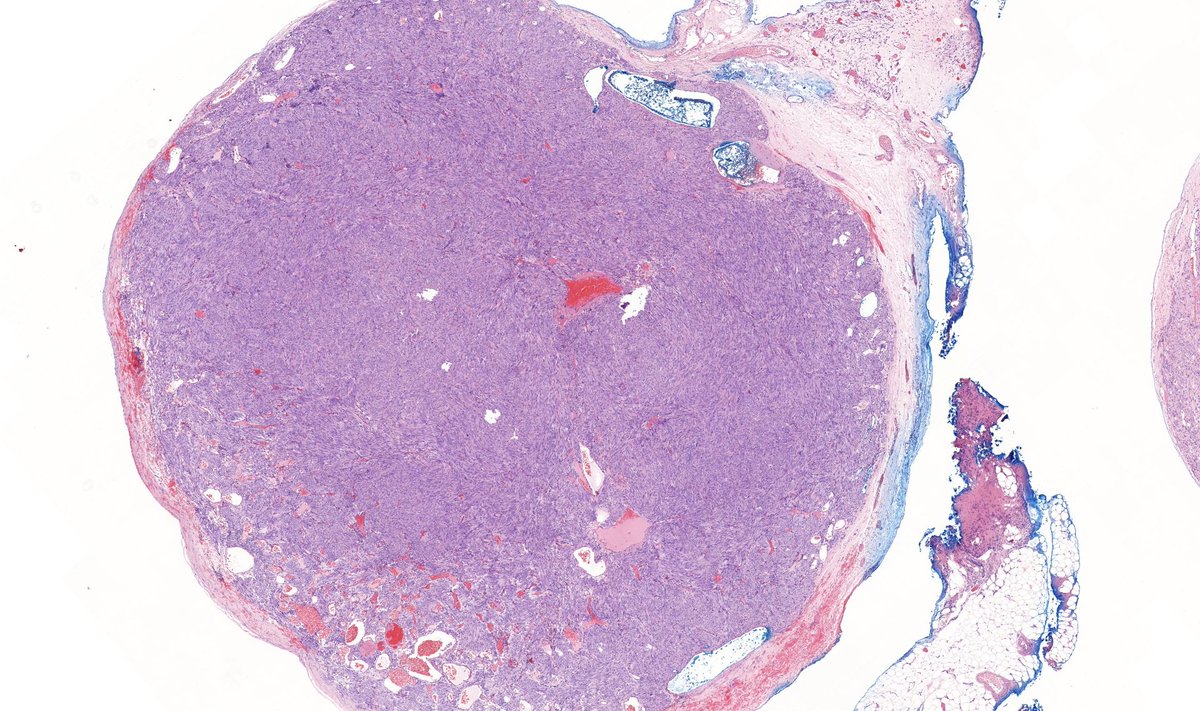 Tristan Rutland MBBS FRCPA IFCAP tweet media