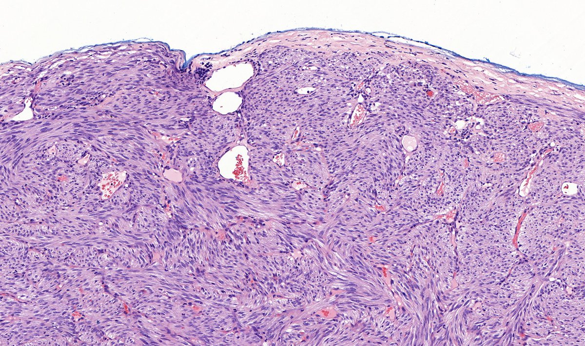 Tristan Rutland MBBS FRCPA IFCAP tweet media