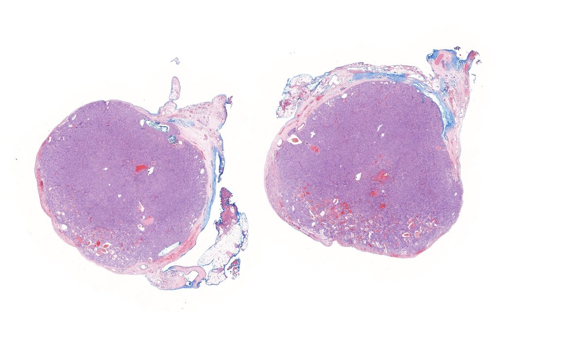Tristan Rutland MBBS FRCPA IFCAP tweet media