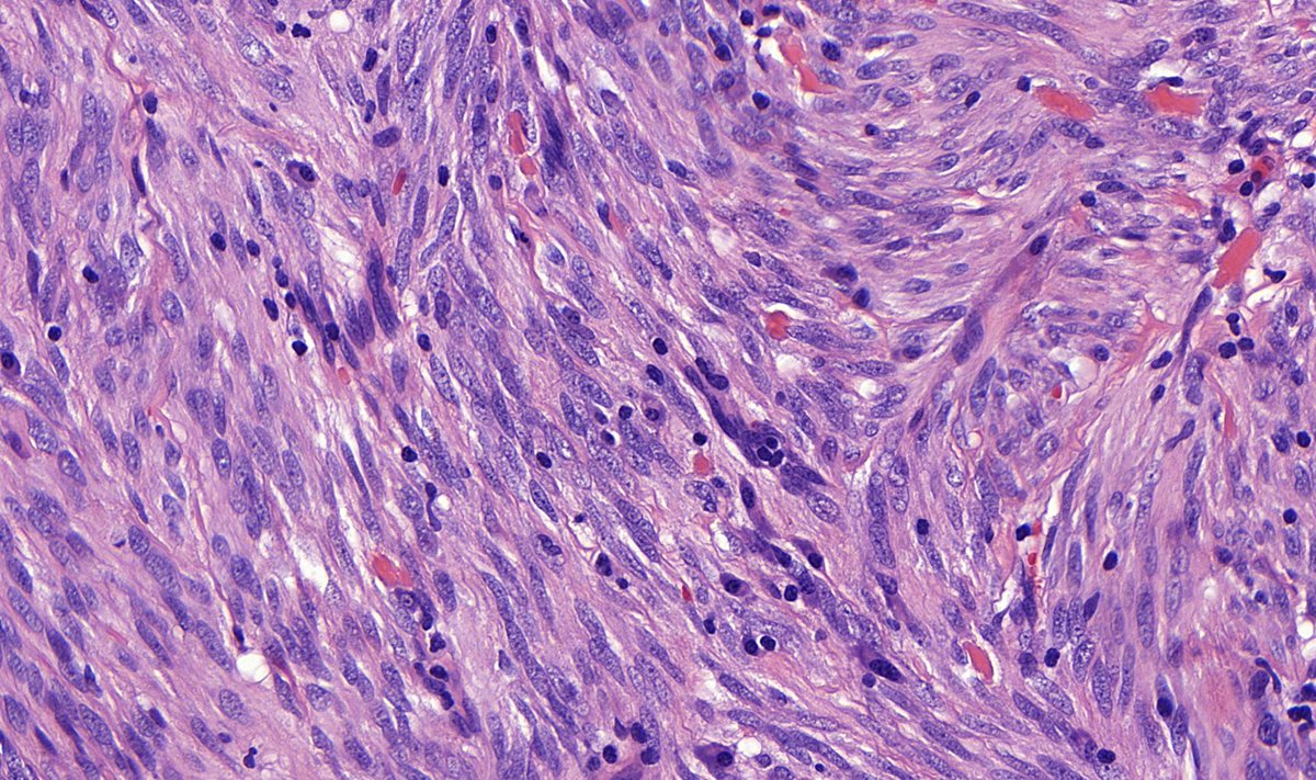 Tristan Rutland MBBS FRCPA IFCAP tweet media