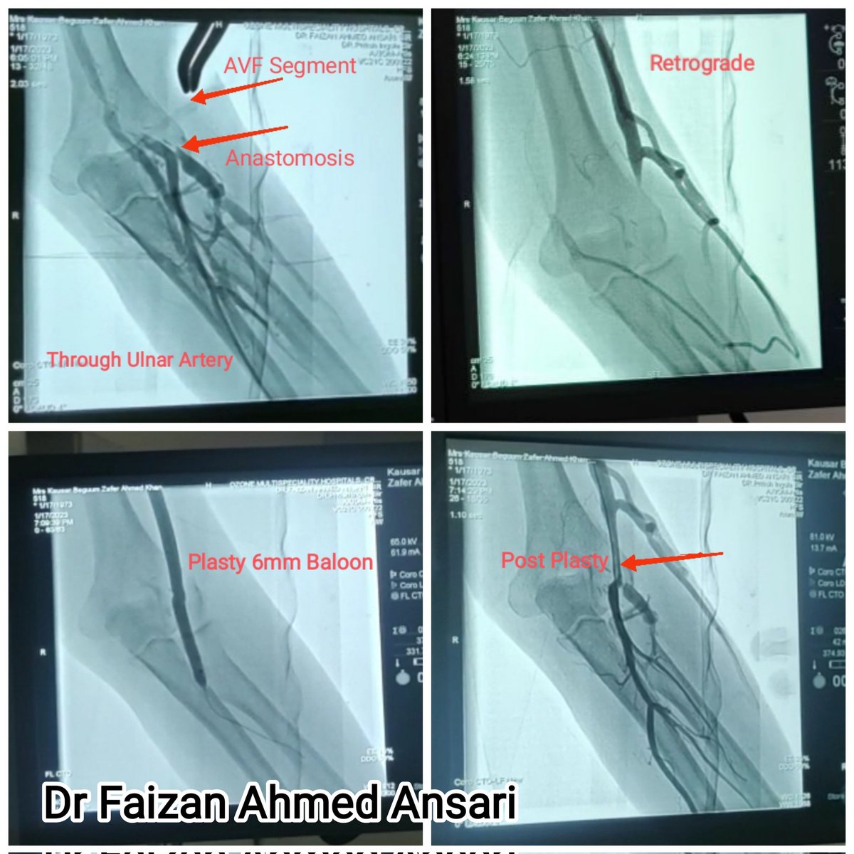 Dr Faizan Ahmed Ansari 🇮🇳 tweet media