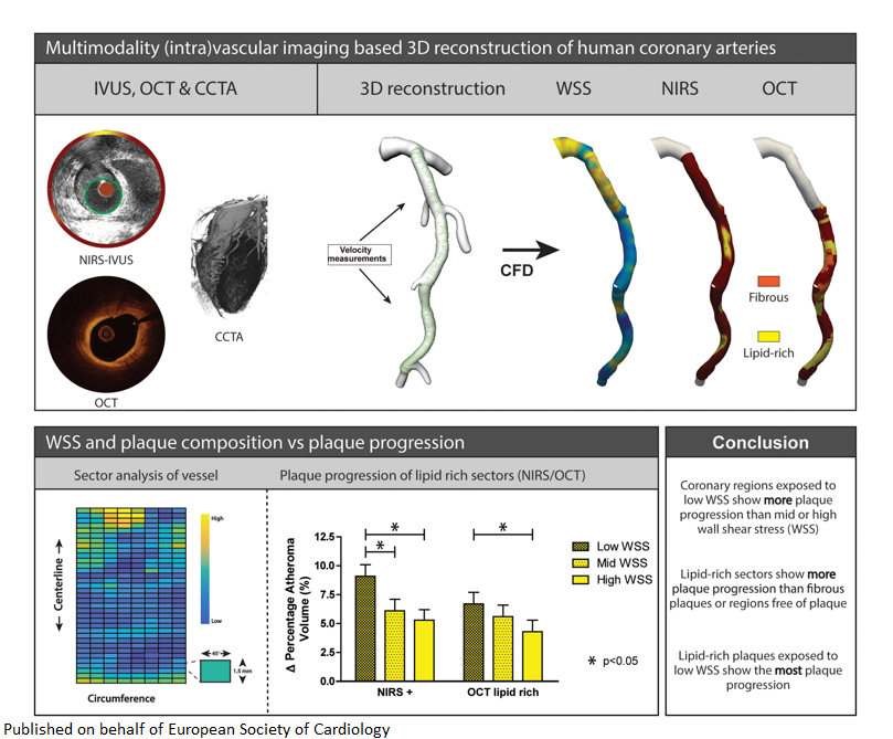 European Society of Cardiology Journals (@esc_journals) on Twitter photo New near-infrared spectroscopy (NIRS) and optical coherence tomography (OCT) study in #CardiovascularResearch reveals a synergistic effect on #plaque progression between low wall shear stress and #lipid-rich plaques
academic.oup.com/cardiovascres/…
<a href="/CVR_TomaszGuzik/">CVR Tomasz Guzik</a> <a href="/DrMikeDrozd/">Mike Drozd</a> <a href="/glenpyle/">Glen Pyle | #WomensHeartHealth ❤️🩹🖇️</a> New near-infrared spectroscopy (NIRS) and optical coherence tomography (OCT) study in #CardiovascularResearch reveals a synergistic effect on #plaque progression between low wall shear stress and #lipid-rich plaques
academic.oup.com/cardiovascres/…
<a href="/CVR_TomaszGuzik/">CVR Tomasz Guzik</a> <a href="/DrMikeDrozd/">Mike Drozd</a> <a href="/glenpyle/">Glen Pyle | #WomensHeartHealth ❤️🩹🖇️</a>