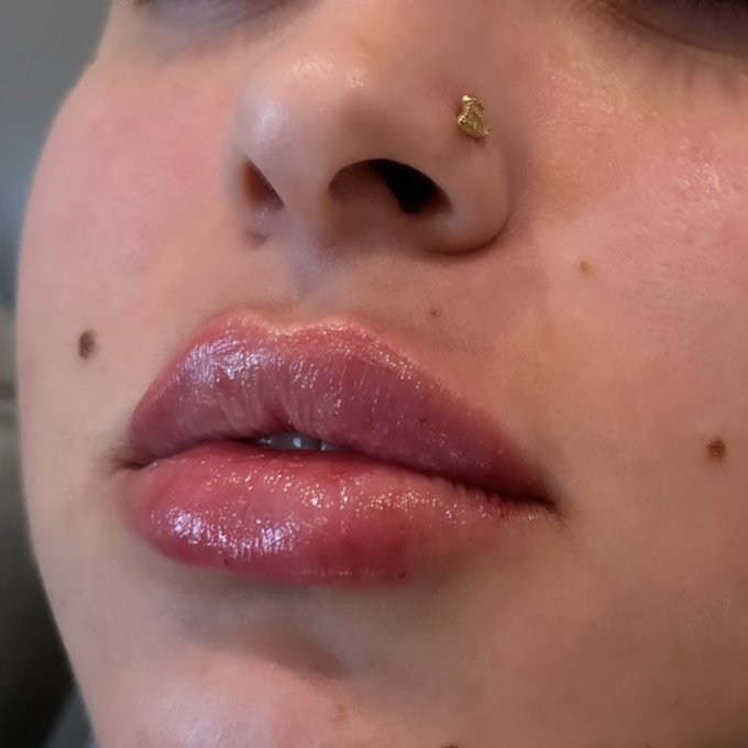 Got my second round of lipfiller &amp; I just wanted to show how mf pretty they are🥰 https://t.co/RmEFDD