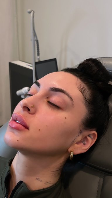 Got my second round of lipfiller &amp; I just wanted to show how mf pretty they are🥰 https://t.co/RmEFDD