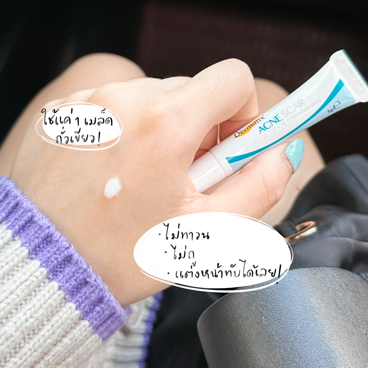 Hamkdy_'s tweet photo. เจลลดรอยสิวที่เราชอบมาก dermatix acne scar ใช้หมดไป 3 หลอดแล้ว 🌟 ดีตรงที่ไม่ต้องถูวน! แต้มแล้วจบ เนื้อซิลิโคนเจล ไม่มัน ไม่อุดตัน ไม่เป็นคราบ ยิ่งรอยใหม่ 7 วันเริ่มจางแล้วค่ะ มี ActivGCS ช่วยให้หลุมสิวตื้นขึ้น ลดการอักเสบได้ด้วย ใครมือซนชอบแกะสิวไปซื้อเถอะ แนะนำมาก 100/10 https://t.co/qxKGouv007