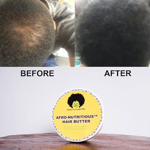 ScienceFitDon's tweet photo. Before & After
Afro-Nutritious Hair Butter
*Customer Results*
Visit https://t.co/NbGUD0WfgZ
#review #skincarereview #customerreview #hairresults #afronutritious #hairbutter #hairgrowth #haircare #hairrepair #damagedhair #recedinghair #chronicdryscalp #Blackhair #greyhair https://t.co/zT63Paod5a