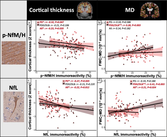 NeuroLaura's tweet photo. Publication online! 🚨 On the regional distribution of neurofilament light in the human brain and it's association with pathological hallmarks and neuroimaging measures in PD and PDD. Great work by @FrigerioIrene &amp; co!

https://t.co/V5PrG9uYAG https://t.co/gJhuqqkQZe