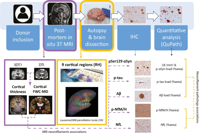 NeuroLaura's tweet photo. Publication online! 🚨 On the regional distribution of neurofilament light in the human brain and it's association with pathological hallmarks and neuroimaging measures in PD and PDD. Great work by @FrigerioIrene &amp; co!

https://t.co/V5PrG9uYAG https://t.co/gJhuqqkQZe