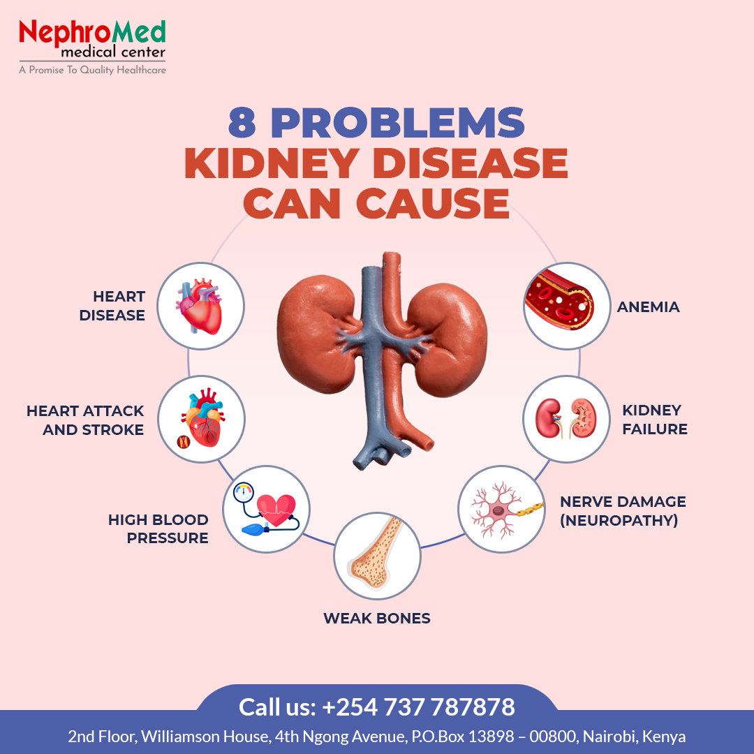 Kidney disease can lead to many different health problems, including high blood pressure and heart disease....

Make an appointment today to find out more about how we can help.

#kidney #kidneydisease #kidneyhealth #chronickidneydisease #kidneydiseasesymptoms #kidneyfunction