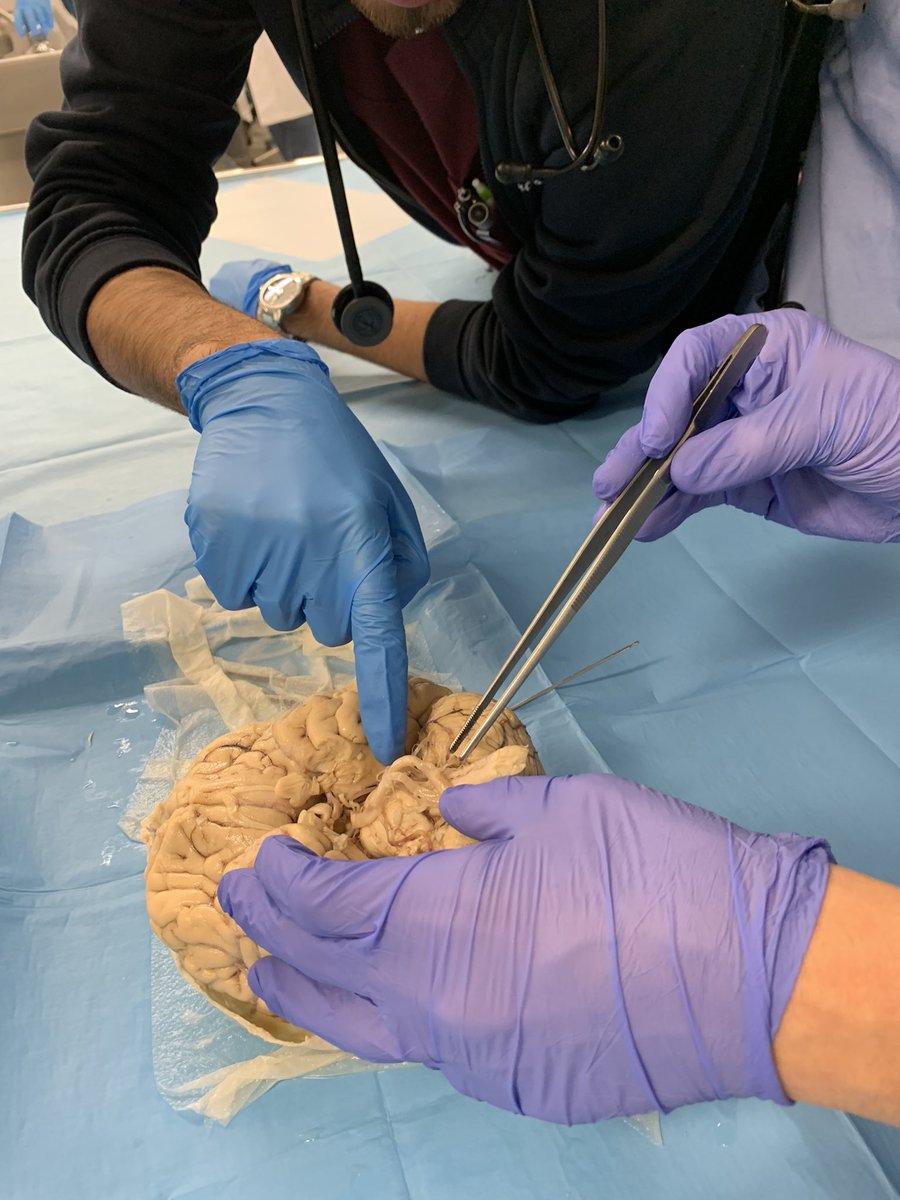 Our Winterschool ends with brain cutting of #Alzheimer and #Parkinson cases at the Institute of Anatomy @CESNE4 @MovementPadova #Brain bank @UniPadova