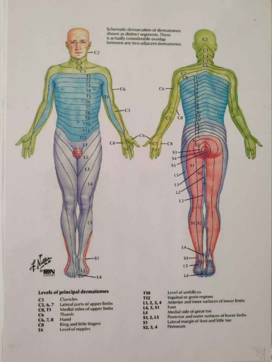 minedacademy's tweet photo. Dermatomes diagrammatic representation.

#Physiotherapy #Physio #PhysicalTherapy #ExercisePrescription #CriticalThinking #PsychoSocial #dermatome #myatome https://t.co/vbo8HeoNvm
