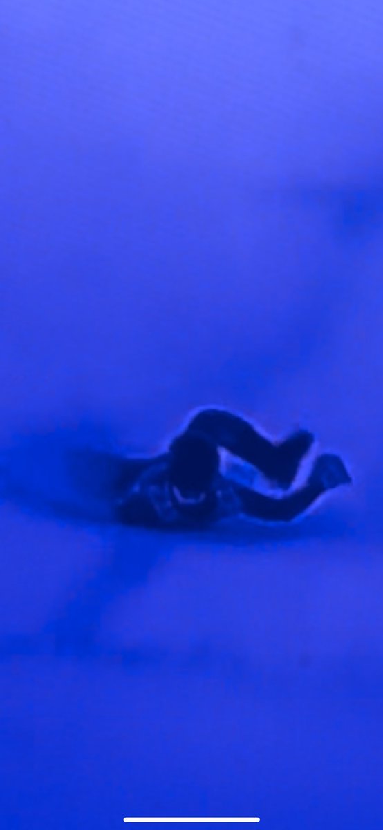 CBalimani's tweet photo. @AudunSkicross Leg definitely looks broken https://t.co/vL2IUIbxiz