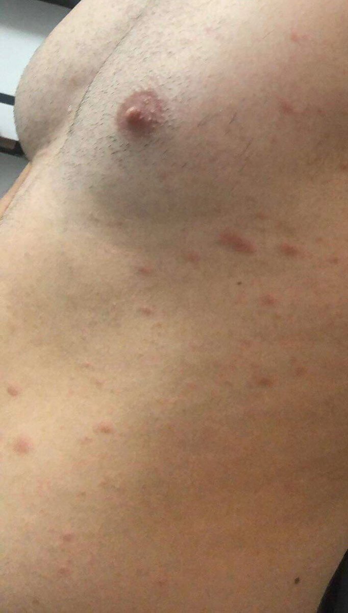 Alex Carignan tweet media