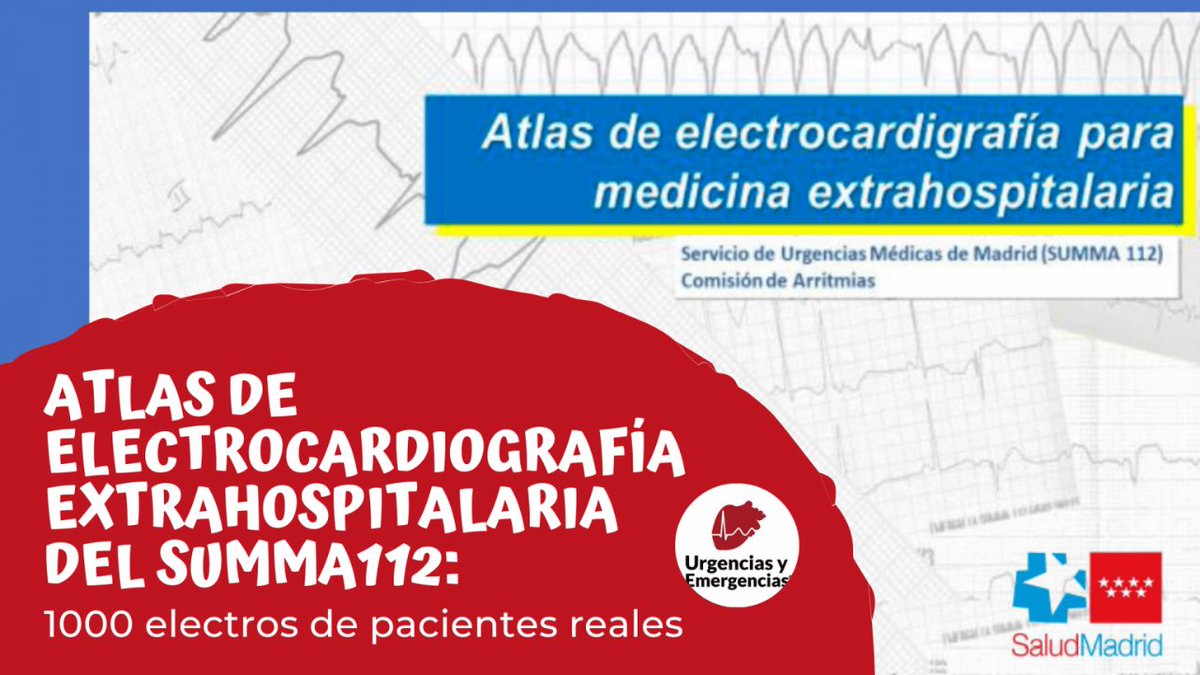urgenciasemerge's tweet image. ⚡️1000 electros de #pacientes reales 

🗣️ El #SUMMA112 después de publicar su Manual de Ventilación Mecánica ahora también disponemos del Atlas de Electrocardiografía extrahospitalaria del SUMMA112: 1000 electros reales. 📘

 ⚡️⚡️⚡️urgenciasyemergen.com/atlas-electroc…

#UrgenciasyEmergencias