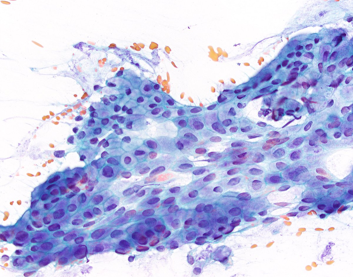 Sarah J. Wu, MD, PhD tweet media