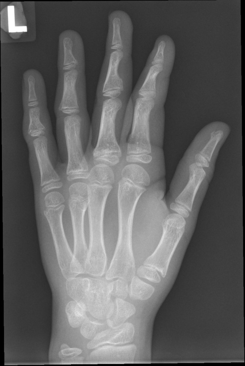 Paul McCoubrie tweet media